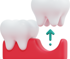 Tooth Extractions in Cleveland